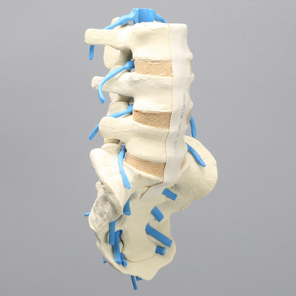 Spine, Lumbar with Nerve Roots, L3-Sacrum, Foam Cortical