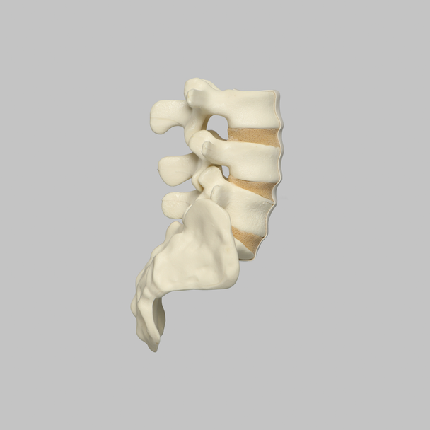 Spine, Lumbar Vertebrae, Anterior Ligament, L3-Sacrum, Solid Foam