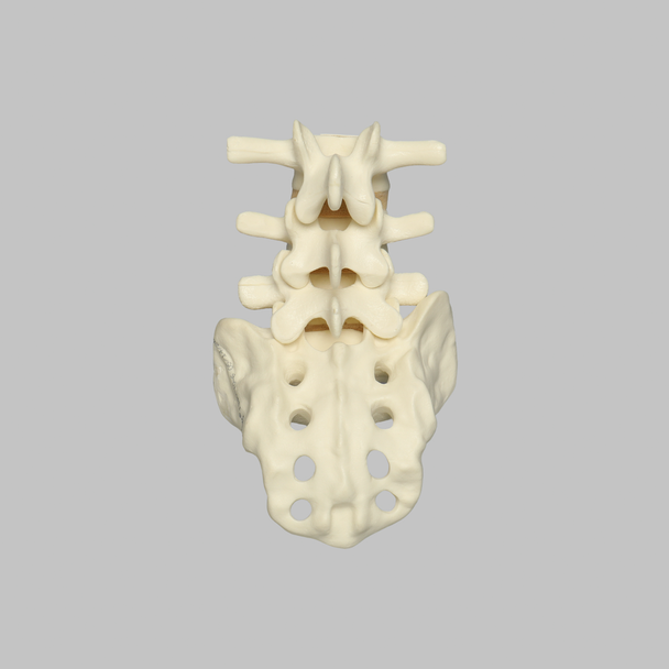 Spine, Lumbar Vertebrae, Anterior Ligament, L3-Sacrum, Solid Foam