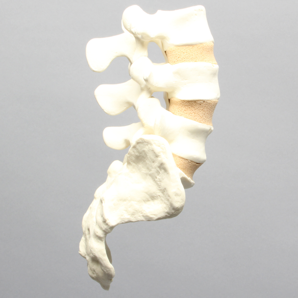 Spine, Lumbar Vertebrae, Posterior Ligament, L3-Sacrum, Solid Foam