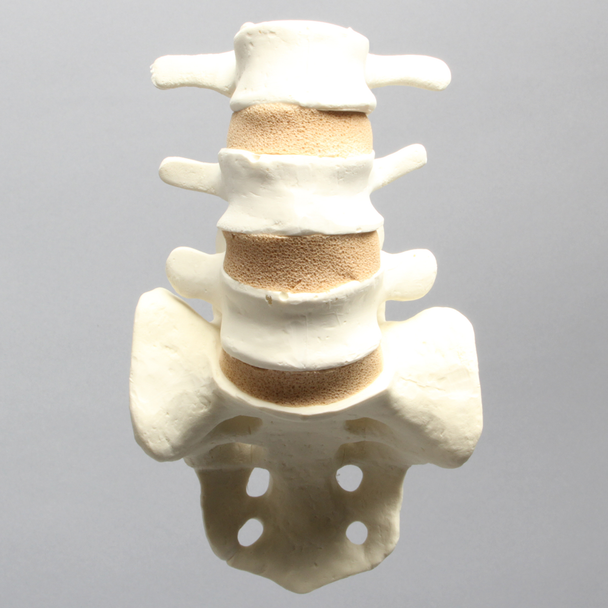 Spine, Lumbar Vertebrae, Posterior Ligament, L3-Sacrum, Solid Foam
