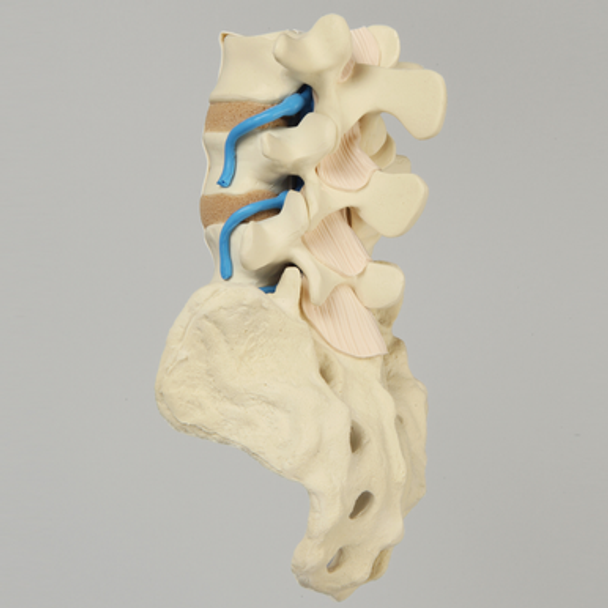 Spine, Lumbar Vertebrae with Nerve Roots and Ligamenta Flava, L3-Sacrum, Solid Foam