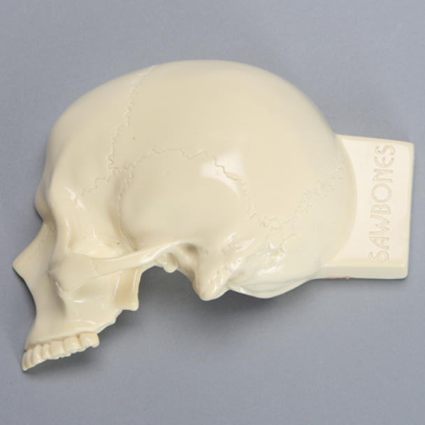 Partial Skull with Brain for Craniotomies