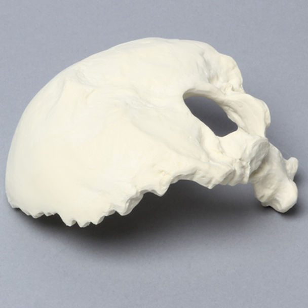 Occipital, Solid Foam