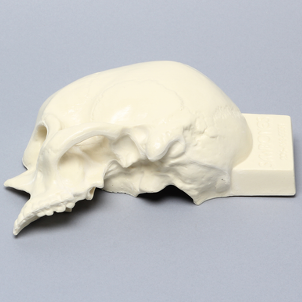 Skull, Left Partial, Foam Cortical, with Vise Attachment