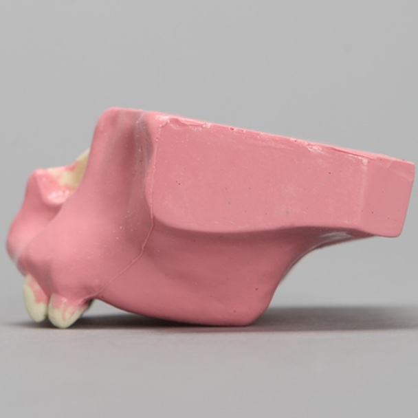 Maxilla with Gum Tissue