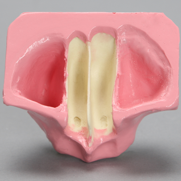 Maxilla with Gum Tissue