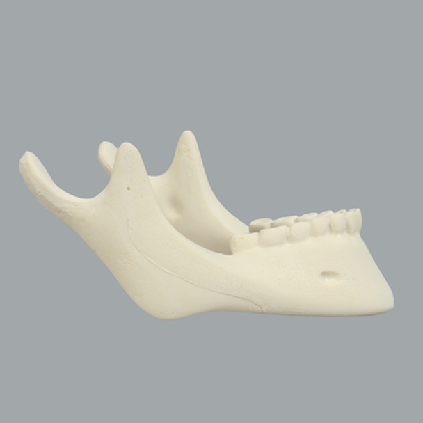 Mandible with Teeth, Solid Foam
