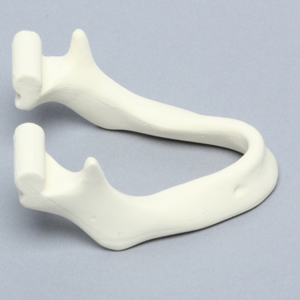 Mandible with Knife Ridge Deformity
