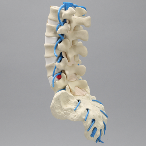 Spine, Lumbar, Herniated Disc, Solid Foam