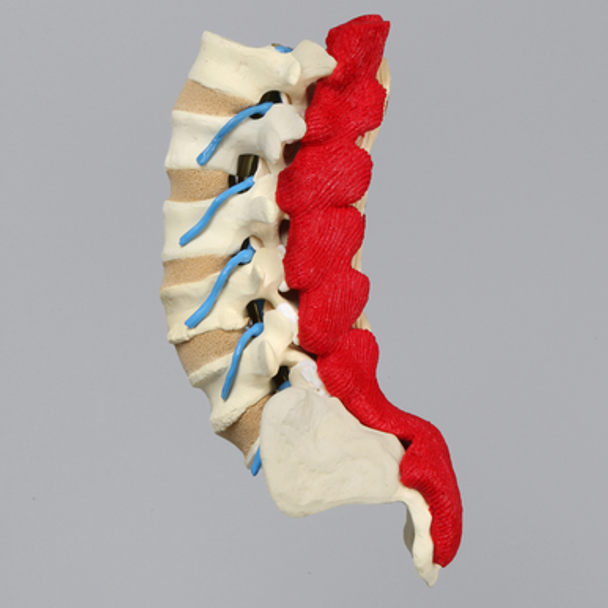 Spine, Lumbar, Nerves, Muscles, and Cartilage, Solid Foam