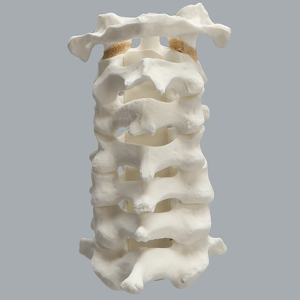 Spine, Cervical with Posterior Ligament, Solid Foam
