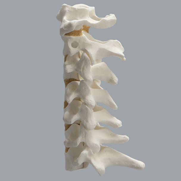 Spine, Cervical with Posterior Ligament, Solid Foam