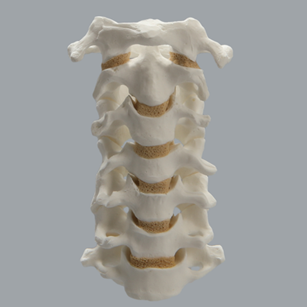 Spine, Cervical with Posterior Ligament, Solid Foam