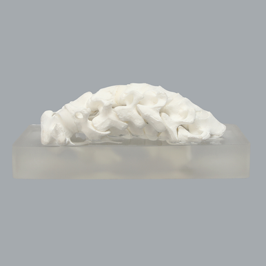 Spine, Cervical, Non-slip Block, Solid Foam