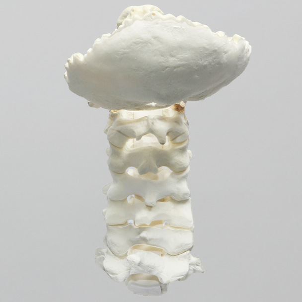 Spine, Cervical with Occipital, Posterior Ligament, and Tan Discs, Solid Foam