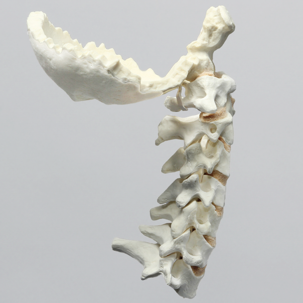Spine, Cervical with Occipital, Posterior Ligament, and Tan Discs, Solid Foam