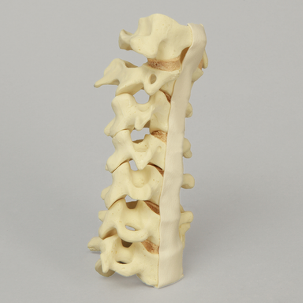 Spine, Cervical without Posterior Ligament, Solid Foam