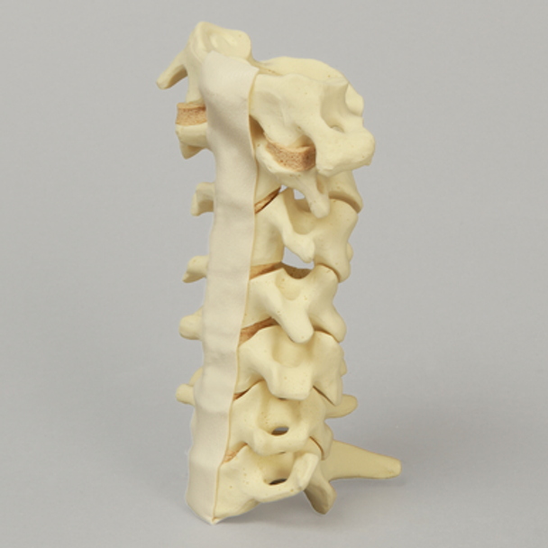 Spine, Cervical without Posterior Ligament, Solid Foam