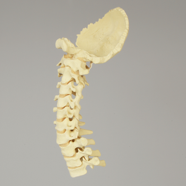 Spine, Occipital-T3, Posterior Ligament and Tan Discs, Solid Foam