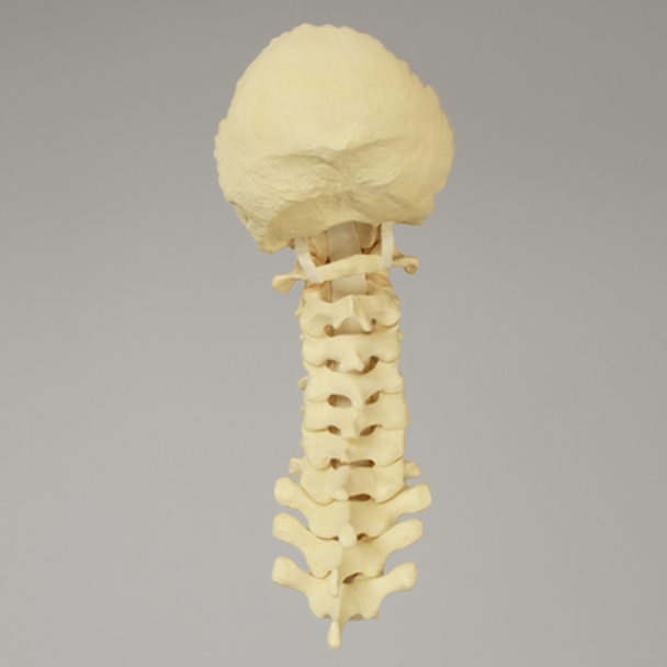 Spine, Occipital-T3, Posterior Ligament and Tan Discs, Solid Foam