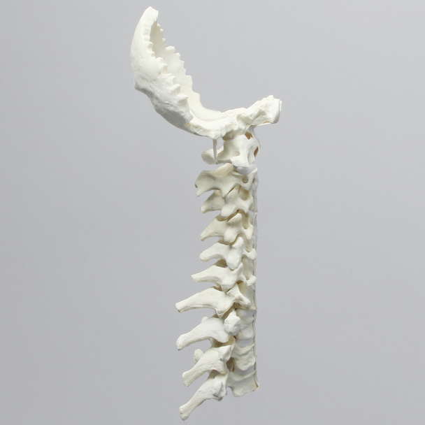 Spine, Occipital-T3, Ligaments and White Discs, Solid Foam