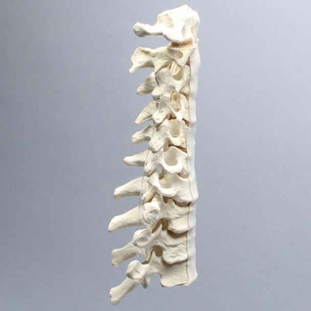 Spine, C1-T3, Ligaments and Tan Discs, Solid Foam