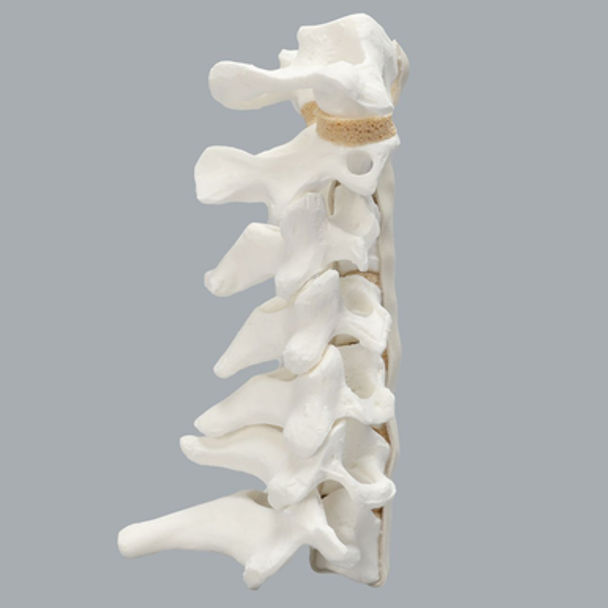 Spine, Cervical, Anterior and Posterior Ligaments, Solid Foam