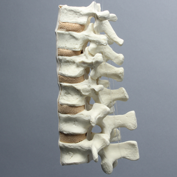Spine, T9-L2, Foam Cortical Shell