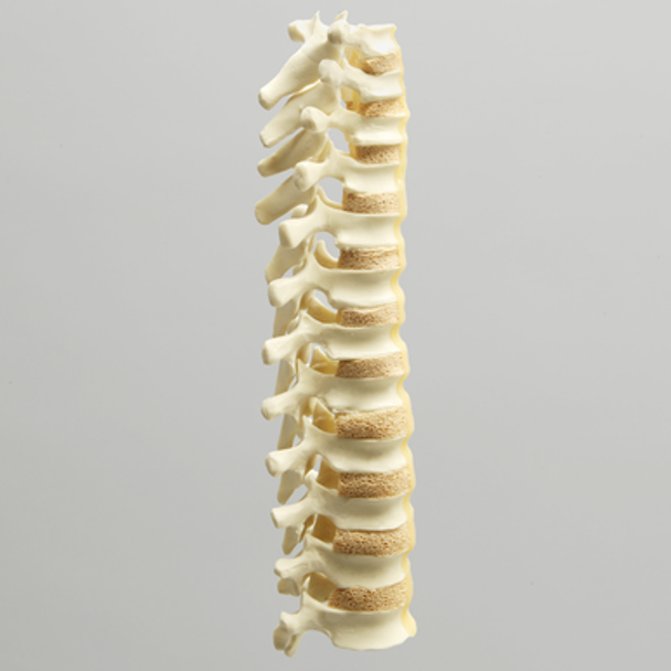 Spine with Reinforced Flex Rod, Pediatric, T1-T12, Solid Foam