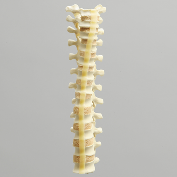 Spine with Reinforced Flex Rod, Pediatric, T1-T12, Solid Foam