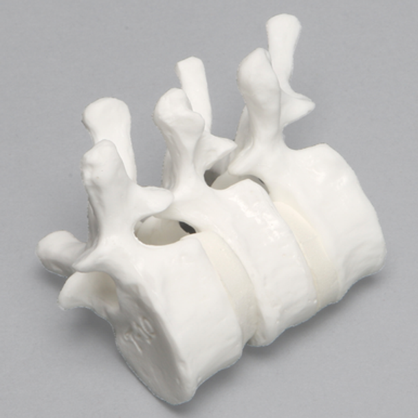 Thoracic Vertebrae, T8-T10, Solid White Plastic