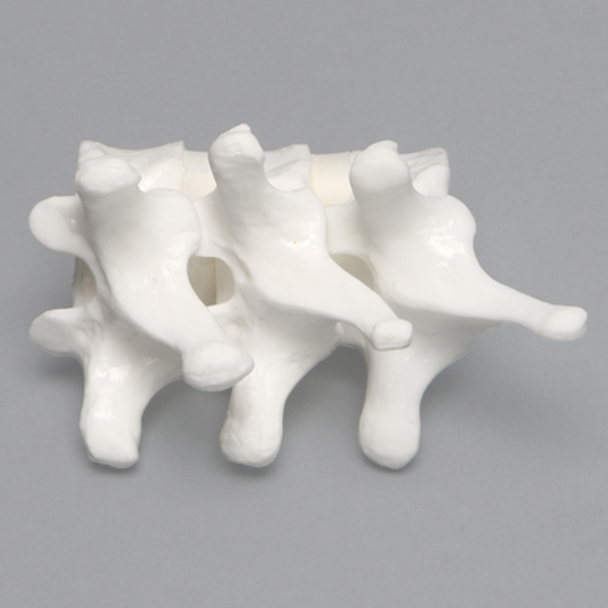 Thoracic Vertebrae, T8-T10, Solid White Plastic