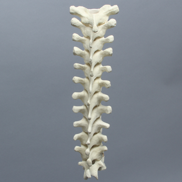 Spine, Thoracic, Foam Cortical Shell
