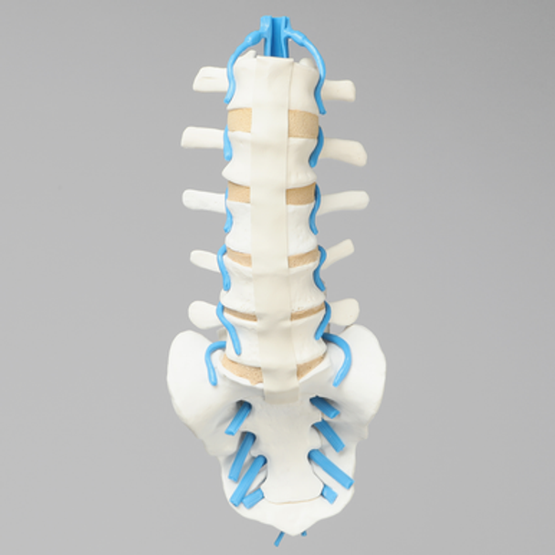 Spine, Lumbar with L3-L5 Stenosis, Solid Foam