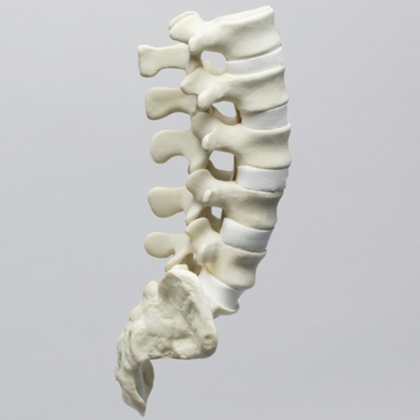 Spine, Lumbar with White Discs and Single Ligament, Solid Foam