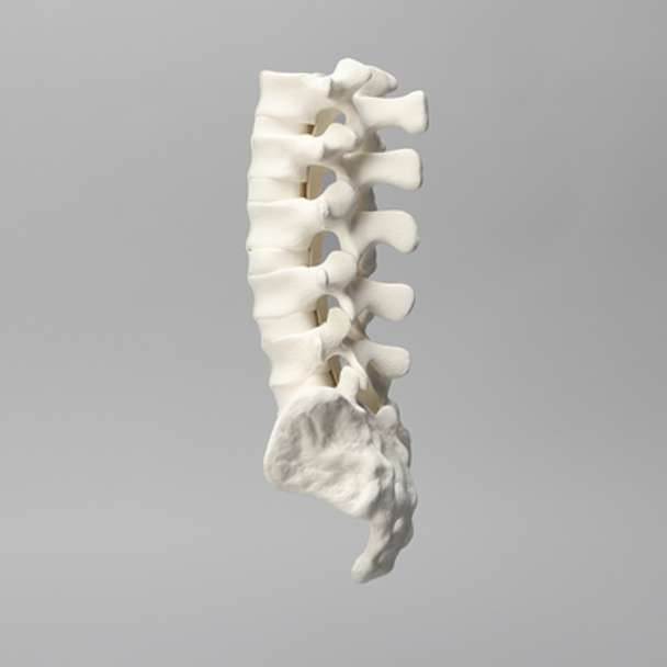 Spine, Lumbar with White Discs, Solid Foam