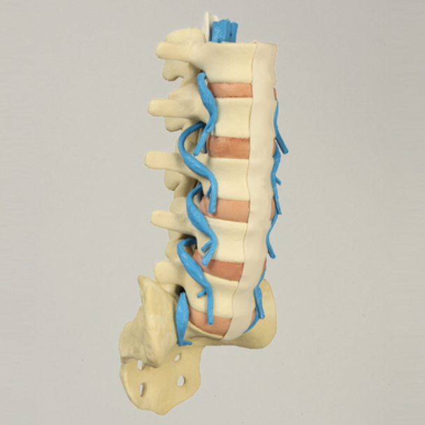 Spine, Lumbar with Nerve Roots and Tan Discs, Solid Foam