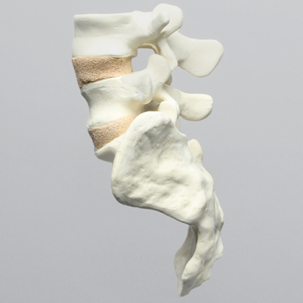 Spine, Lumbar Vertebrae, L4-Sacrum, Without Ligaments, Solid Foam