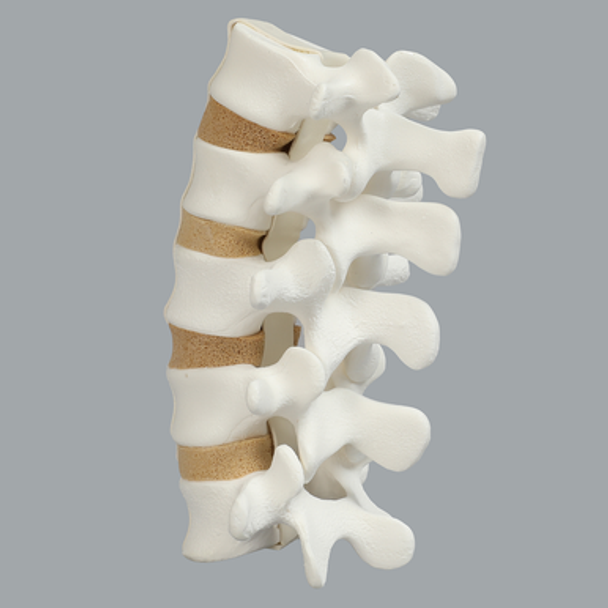 Spine, Lumbar, L1-L5 with Tan Discs, Solid Foam