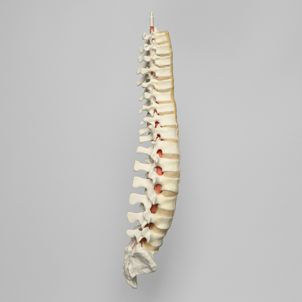 Spine, Scoliosis, T3-Sacrum, Foam Cortical