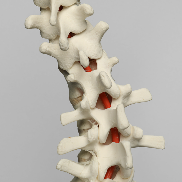 Spine, Scoliosis, T3-Sacrum, Foam Cortical