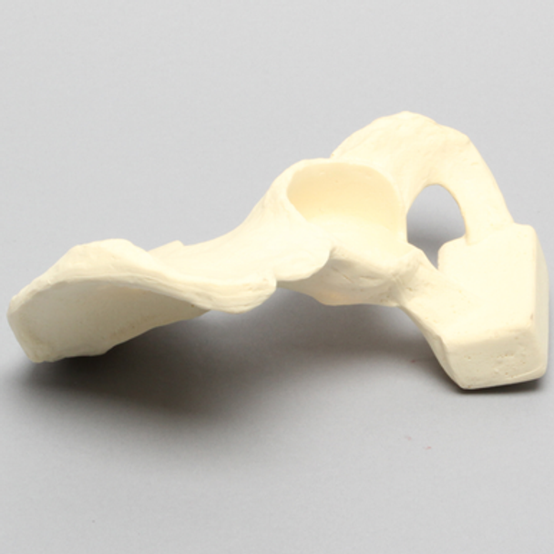 Hemi Pelvis with Global Defect, Male, Solid Foam, Left