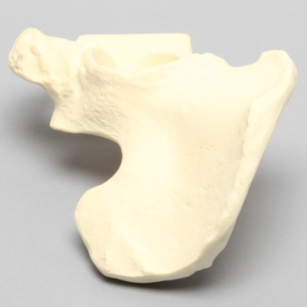 Hemi Pelvis with Global Defect, Male, Solid Foam, Left