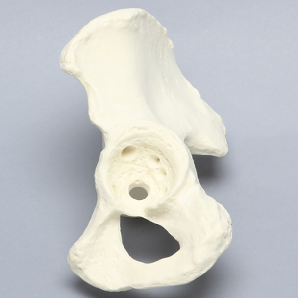 Hemi Pelvis with Bone Loss, Solid Foam, Left