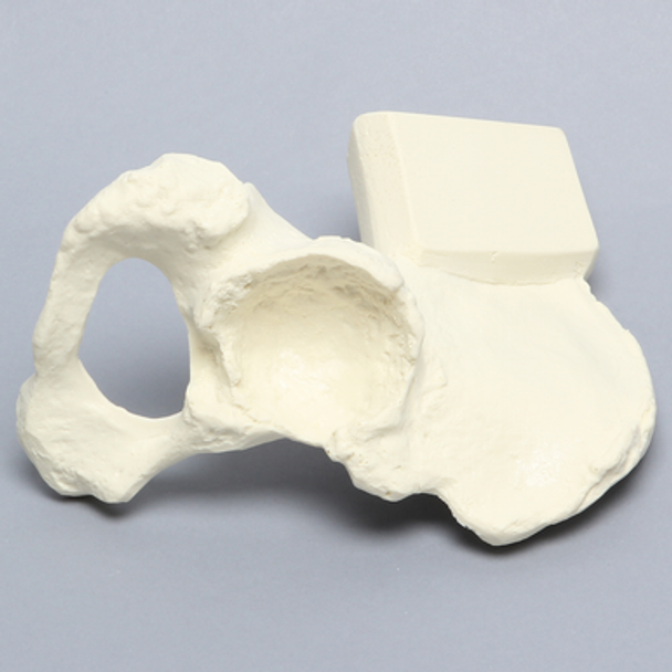 Hemi Pelvis with Dysplasia, Solid Foam, Right