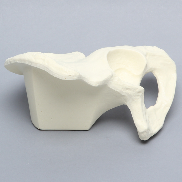 Hemi Pelvis with Reinforced Acetabulum, Solid Foam, Left