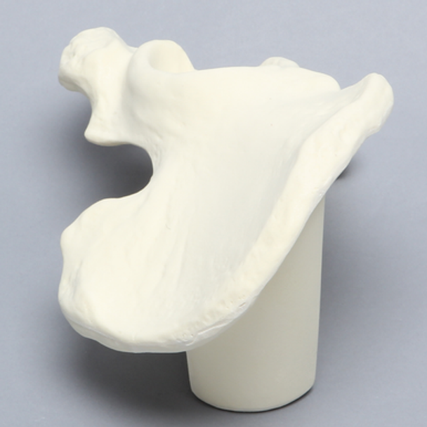 Hemi Pelvis with 52 mm Acetabulum, Left