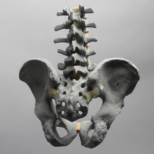 Lumbar Spine with Pelvis, Full Male, Radiopaque