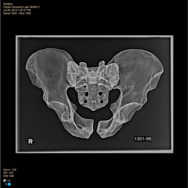 Pelvis, Full Male, Foam Cortical, Radiopaque